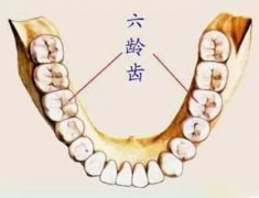 窝沟封闭，保护六龄齿